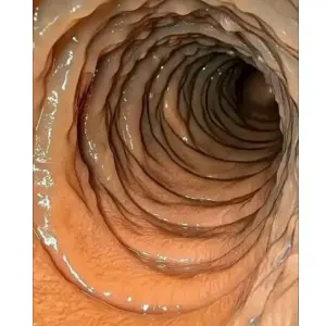 how to naturally tighten the virgina