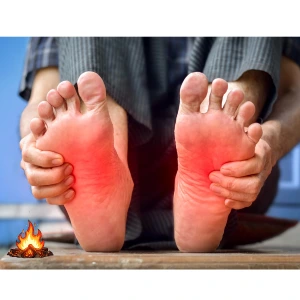 burning feet in women's