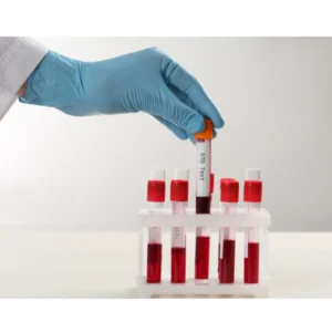 Doctor explaining STD and ED link